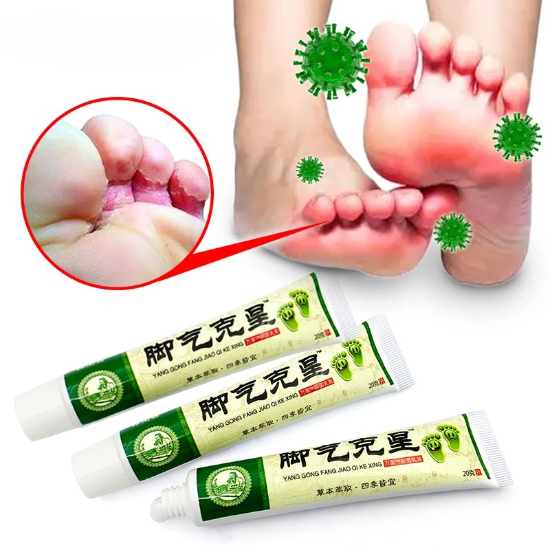 1pcs Foot Tinea Pedis Treatment Cream Treat Beriberi Ointment Anti-itch Inhibits Fungus Peeling