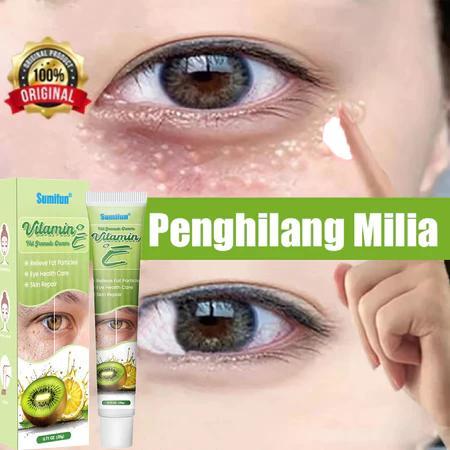 Krim Penghilang Milia Obat Milia Di Bawah Mata Cream Vitamin E Eye Cream Penghilang Milia Syringoma