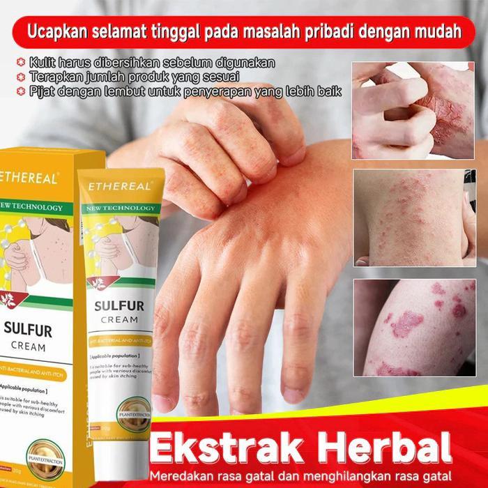 Salep Eksim Anak Salep Obat Salep Salep eksim anak krim popok untuk meredakan gatal Anti Gatal
