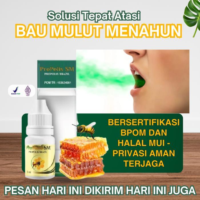 Promo Propolis Sm 6Ml Untuk Penghilang Bau Mulut Menahun Akibat Gigi Berlubang Karang Gigi Asam
