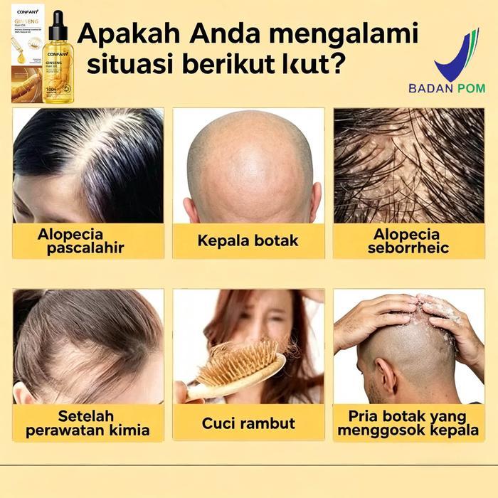 BPOM Ginseng serum penumbuh rambut Serum rambut rontok Hair tonic Hair Growth Serum Serum Anti