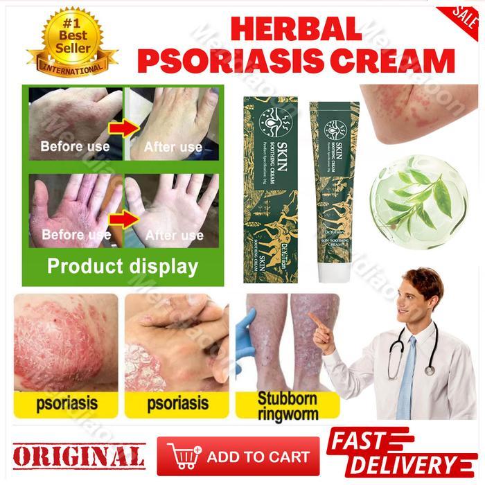 Salep gatal krim gatal kulit Salep gatal selangkangan Salep gatal miss v Salep eksim kering dan