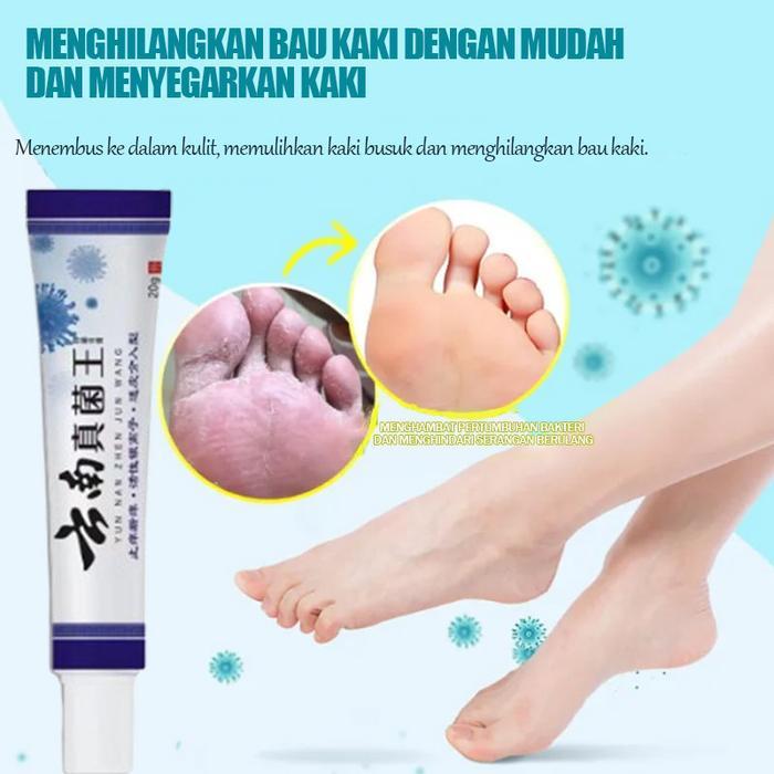 krim perawatan anti bakteri , menghilangkan jamur tinea pedis salep perawatan kaki