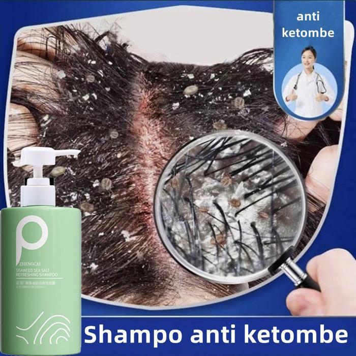 shampoo anti ketombe / sampo anti ketombe dan gatal / sampo anti ketombe ampuh ampuh / sampo anti