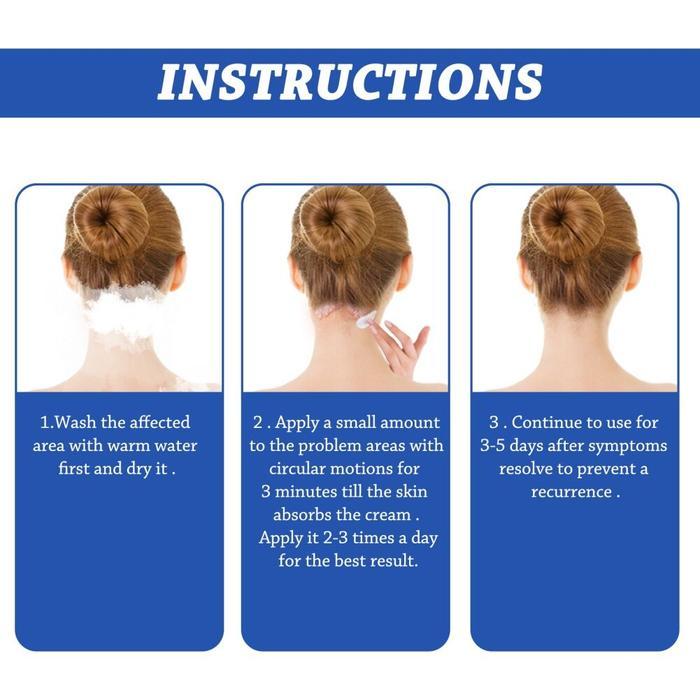 Obat ketombe parah Seborrheic dermatitis cream krim kepala gatal Psoriasis Ketombe Parah Scalp