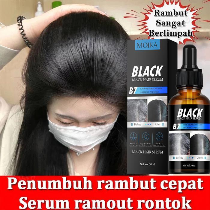 Serum Penumbuh Rambut Obat Penumbuh Rambut Penumbuh Rambut Botak Penumbuh Rambut Penebal Rambut
