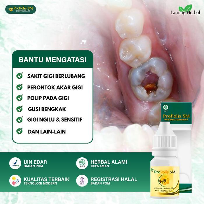 Promo Obat Pencabut Gigi Berlubang Perontok Gigi Sampai Akar Penghancur Gigi Berlubang Cepat Sembuh