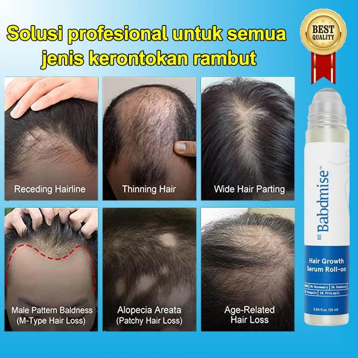 Serum Rambut Rontok Hair Tonic Penumbuh Rambut Serum Rambut Roller 3% Rosemary Oil Obat Penumbuh