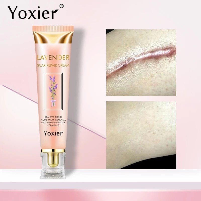 Yoxier Lavender Scar Repair Cream Acne Scar Removal Pigmentation Corrector Remove Stretch Marks Smoo