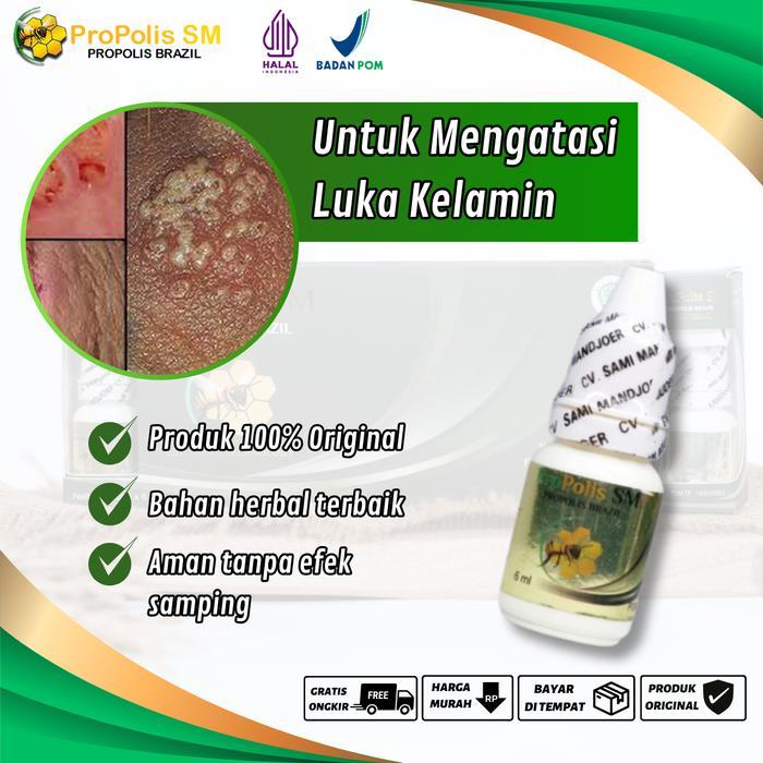 Propolis Sm - Atasi Luka Pada Kelamin Pria, Luka Batang Kelamin Pria, Iritasi Kulit Kelamin, Lecet