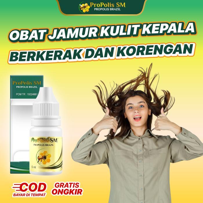 Obat Tinea Capitis Infeksi Kulit Kepala Belakang, Gatal, Propolis SM