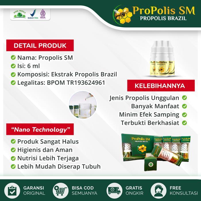 Obat Jamur Kulit Kepala Kapitis, Tinea Capitis Ringworm, Propolis SM