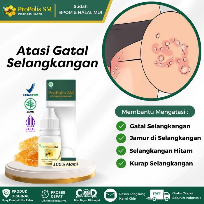 Propolis Sm Salep Oles Untuk Gatal Selangkangan, Jamur Kulit Selangkangan, Selangkangan Hitam Atasi