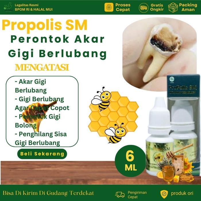 Propolis SM Perontok Akar Gigi Berlubang, Perontok Gigi Bolong, Penghilang Sisa Gigi Berlubang, Gigi