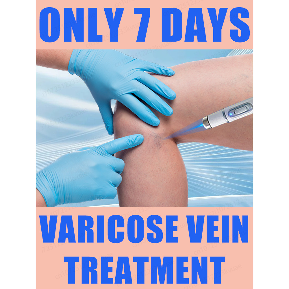 Laser treatment for varicose veins, grade equipment, painless treatment for spider veins and blood