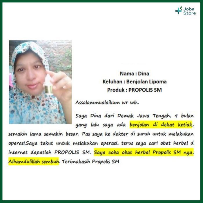 ish8- Penghancur Lipoma Uci Uci Benjolan Herbal Oles Propolis Sm