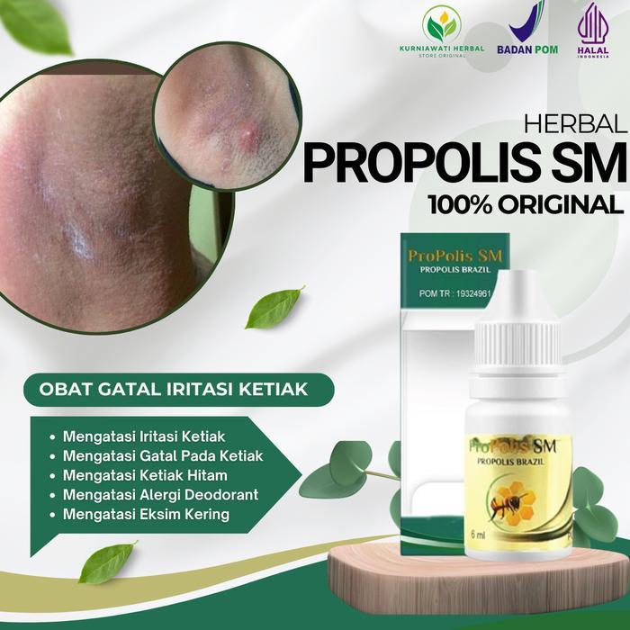 07f1- Propolis Sm Gatal Iritasi Ketiak Alergi Deodorant Ketiak Hitam Bau Eksim Kering Ketiak
