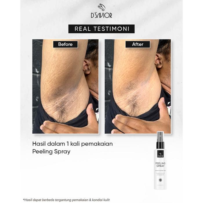 75r2- D'Savior Dsavior D Savior Whitening Body Serum Body Peeling Pencerah