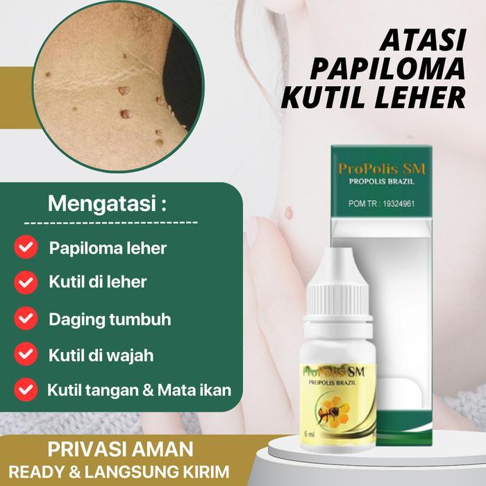 Perontok Papiloma Wajah Dan Di Leher Pembersih Kutil Leher Wajah Penghilang Papiloma Wajah Dan Leher