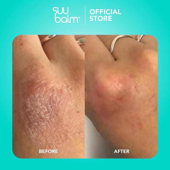 75r2- Adult Body Care Pack - Suu Balm Dual Cooling & Moisturising Cream Body Wash (420Ml) &