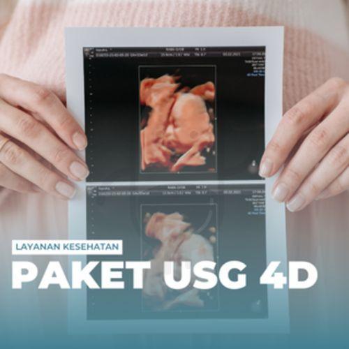 Paket Usg 4D - Klinik Kita