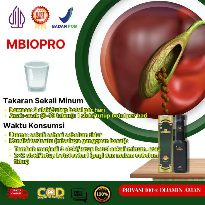 rxi7- Herbal Batu Empedu Paling Ampuh, Penghancur Batu Empedu, Batu Empedu Tanpa Oprasi -