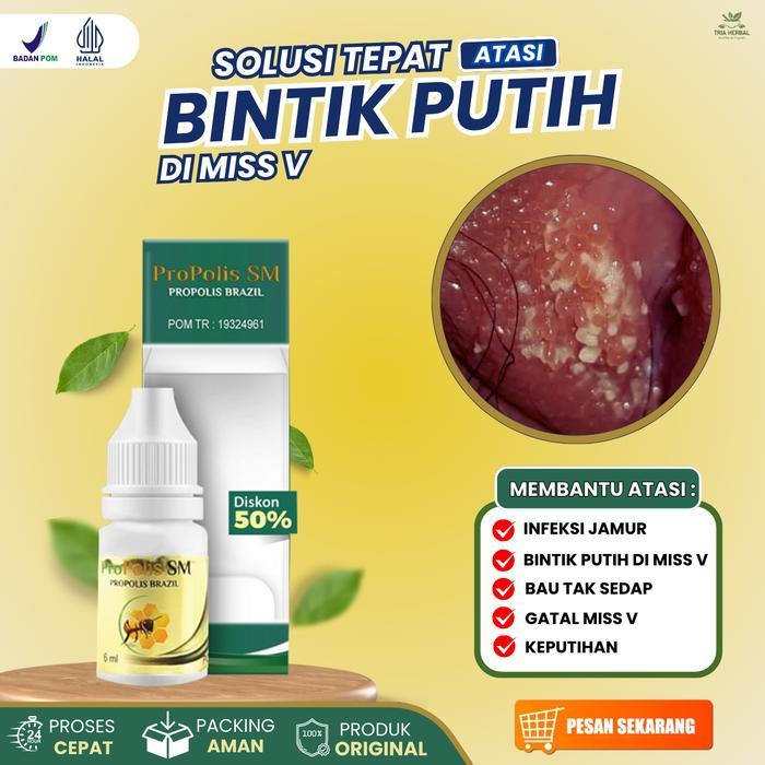 Salep Cair Penghilang Bintik Bintik Putih Miss V, Pereda Gatal Miss V Kewanitaan Akibat Jamur