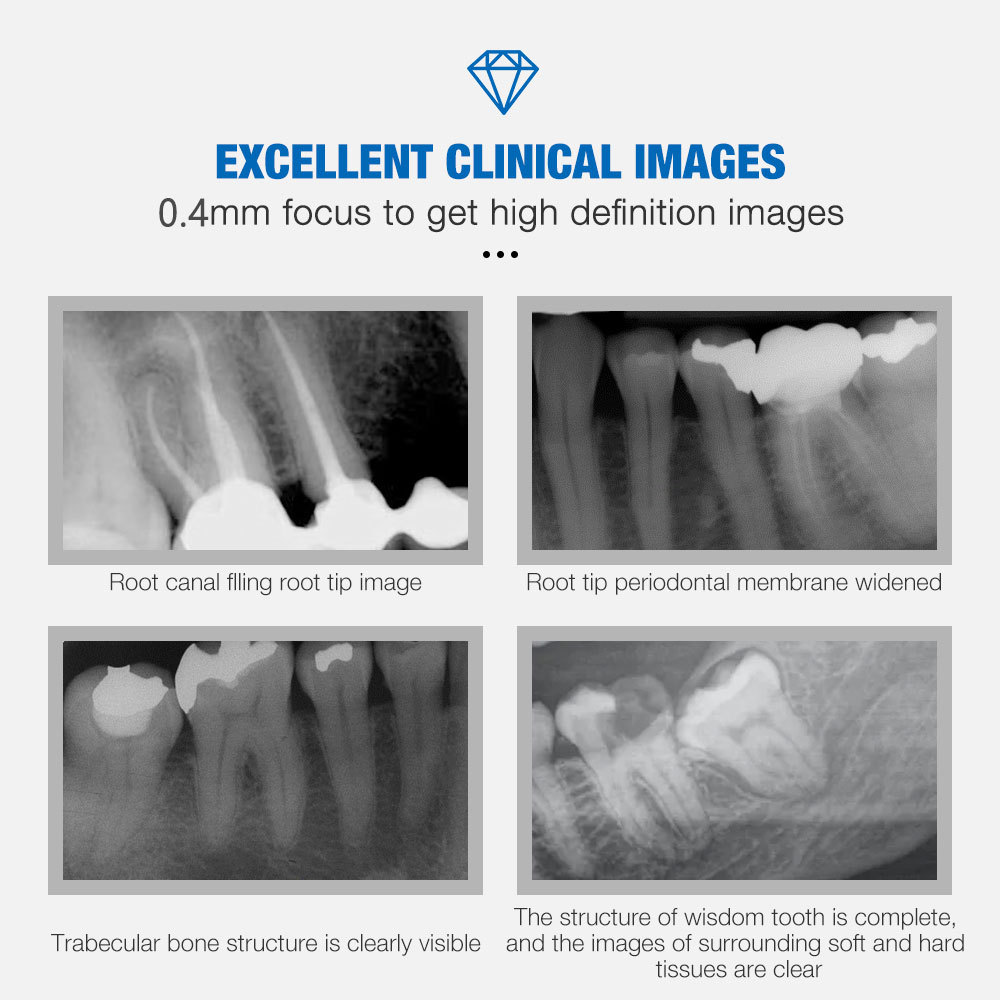 Dental X Ray Portable Dental Imaging System Intraoral Digital X-Ray