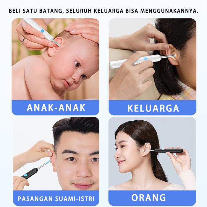 kv3g- Eb Cod Non-Medis Black Alat Pembersih Telinga Led Ear Spoon Terhubung Dengan Ear Spoon