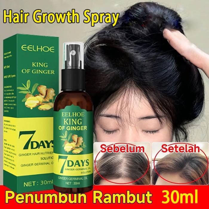 Hair Growth Spray 30ml Ginger Hair Serum Penumbuh Rambut King of Ginger Germinal Oil Serum Anti