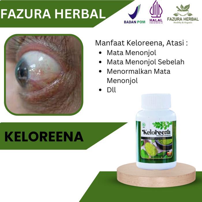 lk5v- Keloreena - Suplemen Atasi Mata Menonjol Menormalkan Mata Menonjol Akibat Hipertiroid