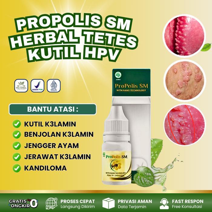 SALE Propolis SM - Kutil Kelamin HPV, Perontok Kutil Kelamin Kutil Anus Pria & Wanita Bintik