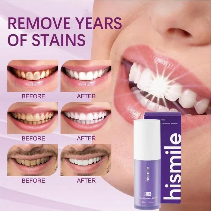 DAYDAY- Pasta Gigi Pemutih Perontok Karang Gigi Perontok Karang Gigi Paling Ampuh 30Ml