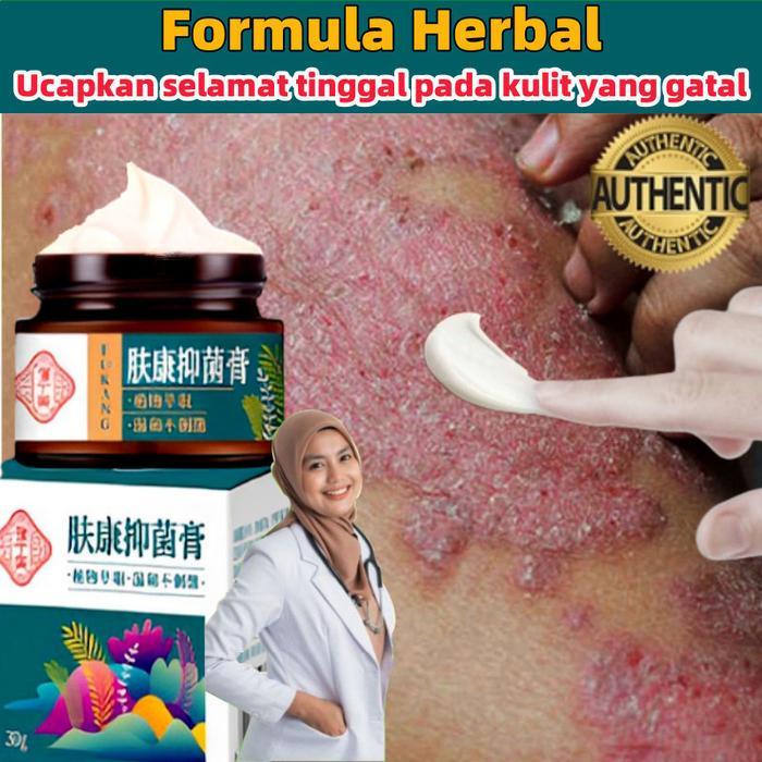 ORI Salep gatal paling ampuh Obat psoriasis obat gatal salep kutil Obat Gatal Salep gatal Salep
