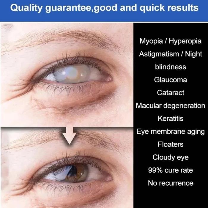 DAYDAY- Khusus Untuk KatarakSpray Tetes Mata Untuk Katarak Spray Mata Rabun Cuci Mata Tetes