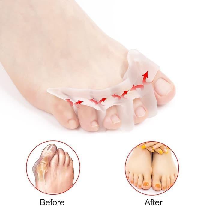 Pemisah Jari Kaki Silikon Gel Toe Separator Jari Jempol Silicon Bunion