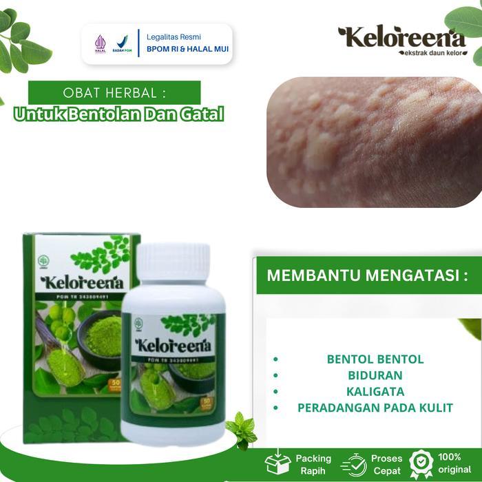MORNINGGILR- Keloreena Mengatasi Bentol Dan Gatal, Biduran, Untuk Kaligata, Biduran Menahun, Untuk