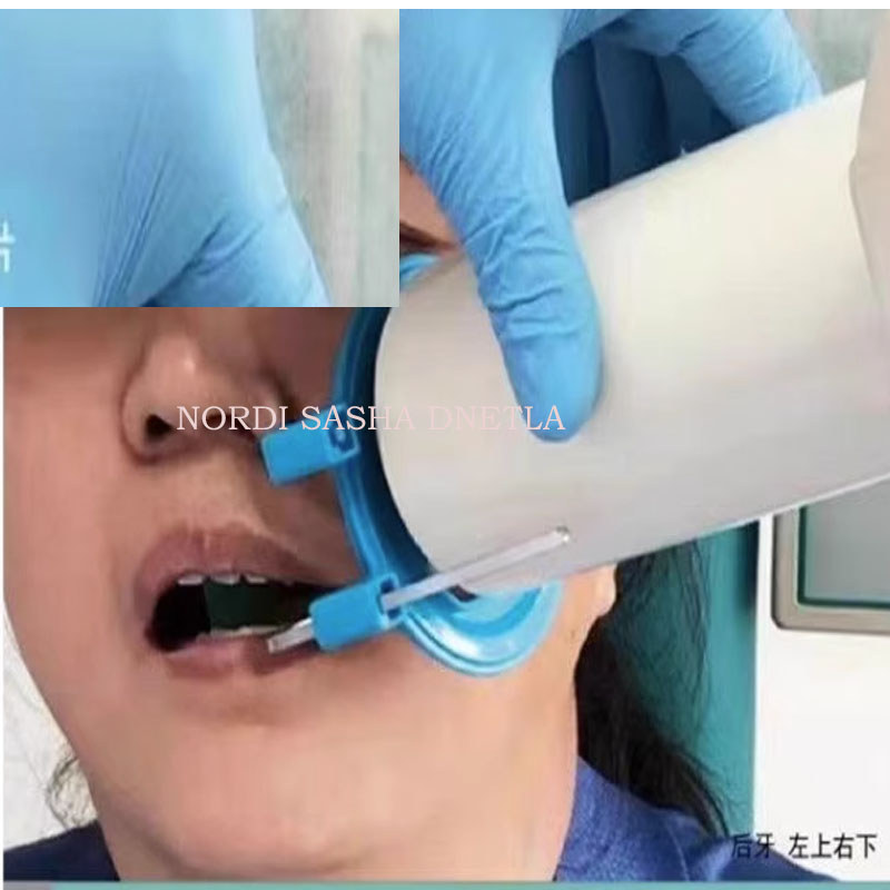 12Pcs/ Set Dental X Ray Rvg Sensor Positioner X-Ray Film Locator Psp