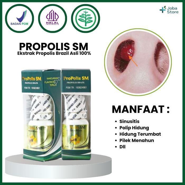 ymlz- Tetes Hidung Polip Hidung Sinusitis Sinus Alami Propolis Sm