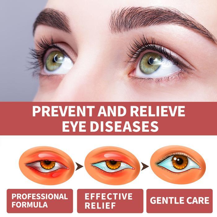 DAYDAY- [Ampuh] Obat Tetes Mata Berlemak Kekuningan Penyakit Pterigium Glukoma Mata Katarak