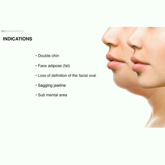 Promo Face Nade Ecer Slimming Wajah Terdaftar Bpom Original