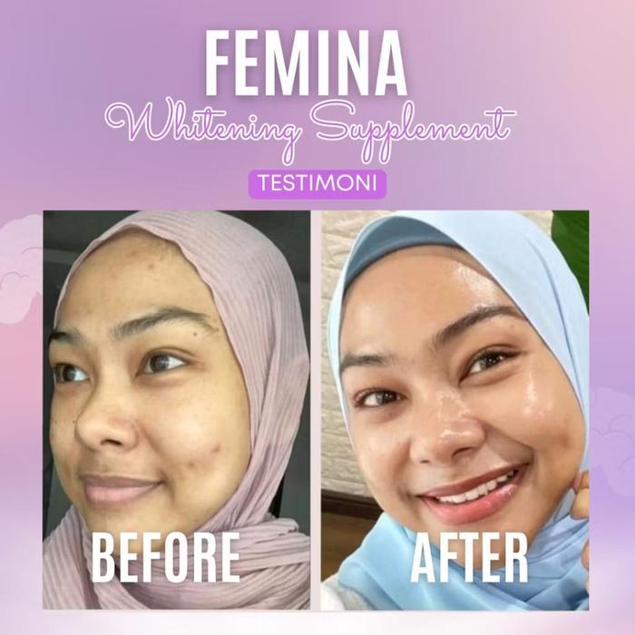 ymlz- Paket 3 Botol + 1 Botol Femina Pemutih Badan Whitening Femina Whitening Supplement