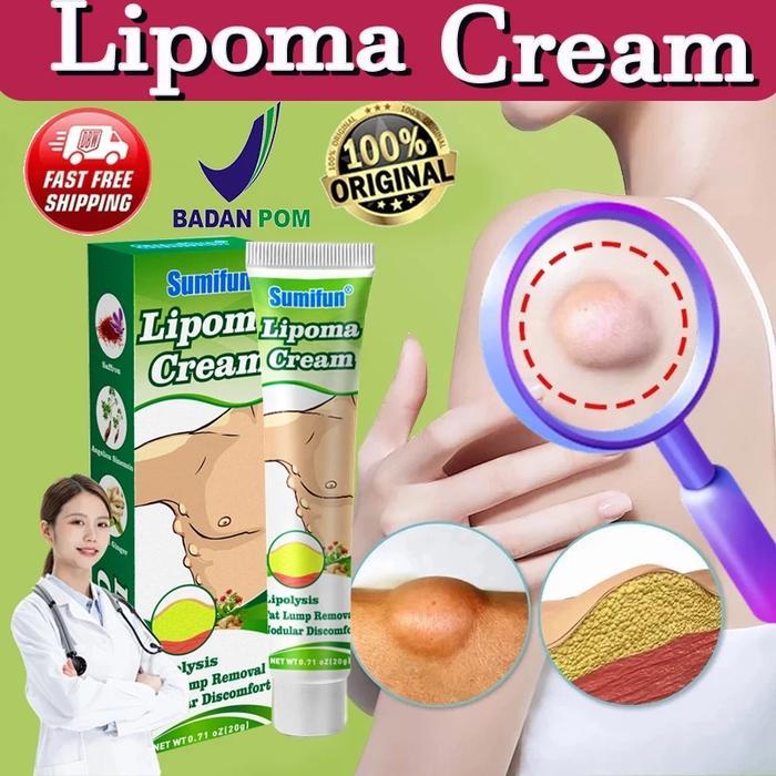 lipoma cream salep benjolan 100% Original Herbal Ampuh lipoma cream salep benjolan 7 days lipoma
