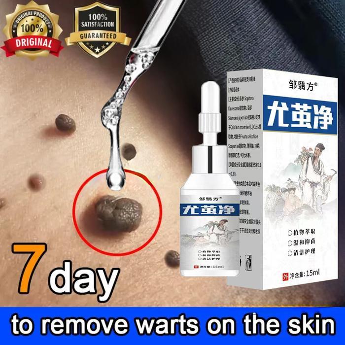 Salep Obat Kutil Paling AmpuhWart Remover obat kutil papiloma di leher, salep penghilang kutil Wart