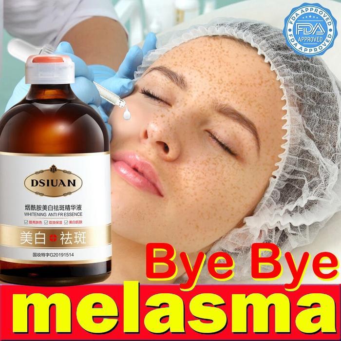 Whitening Freckle Cream Remove Dark Spot & Brightening Serum Anti Freckle Cream Fade Pigmentation