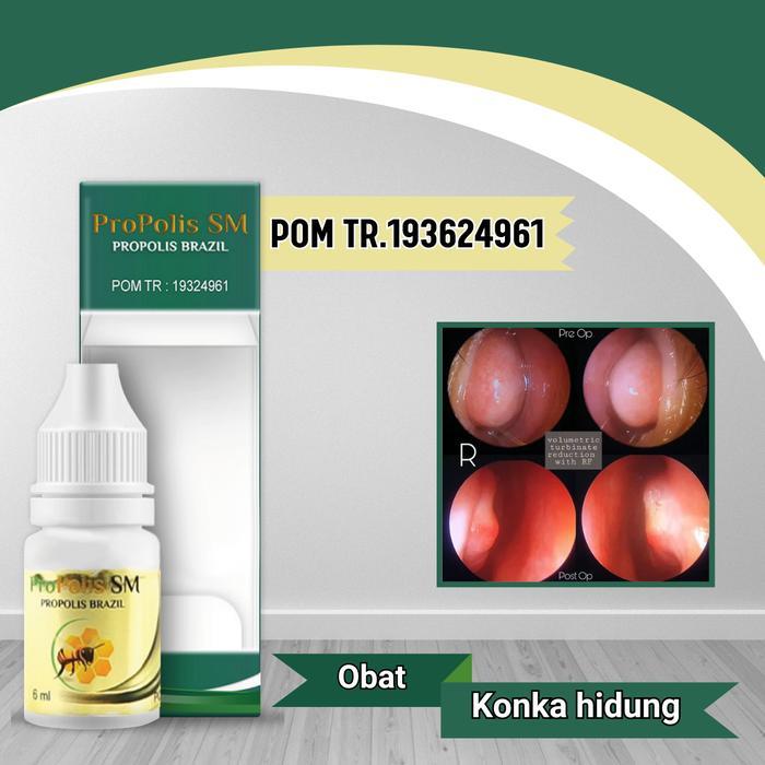 ProPolis SM 6ml - Membantu Atasi Konka Hidung Secara Alami