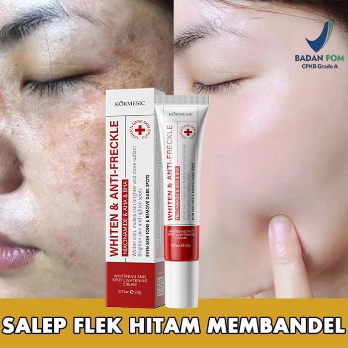 Krim Penghilang Flek Hitam Cream Flek Hitam Membandel Salep Flek Hitam Membandel 20g Menghilangkan