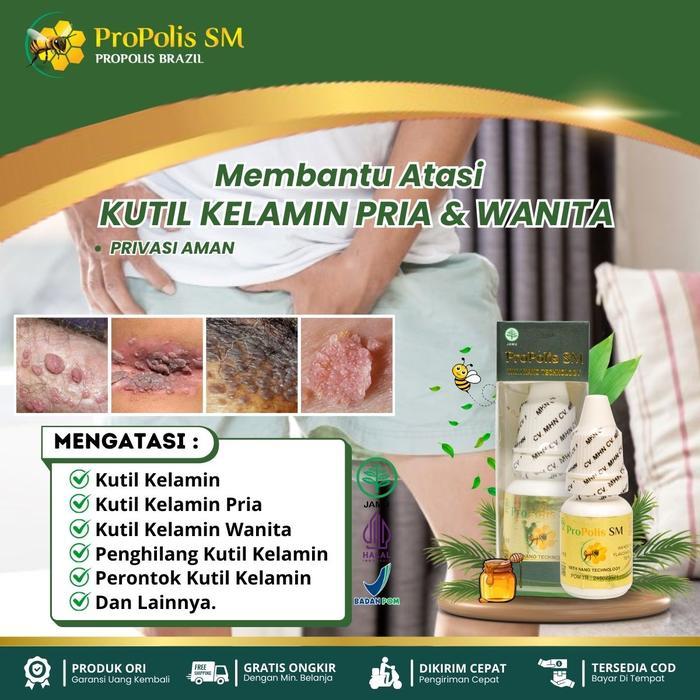 Propolis SM Kutil Kelamin HPV, Perontok Kutil Kelamin Pria / Wanita, Kutil Anus, Salep Kutil