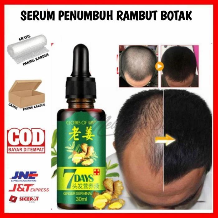serum penumbuh rambut botak