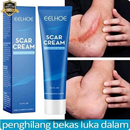 Salep penghilang bekas luka Penghilang bekas luka hitam koreng Penghilang bekas luka di kaki